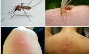 Кто кусает ночью в постели кроме клопов