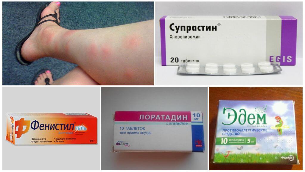 Антигистаминные средства при укусах насекомых