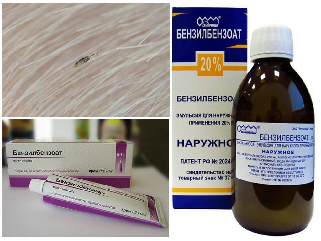 Мазь и эмульсия Бензилбензоата