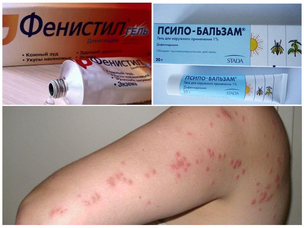 Фенистил и Псило-бальзам