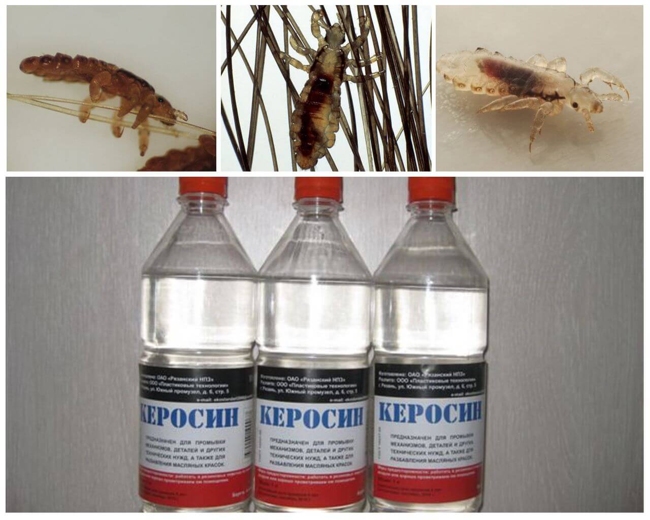 Действие керосина при педикулезе