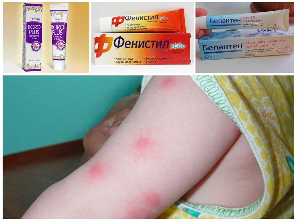 Лечение укусов у детей