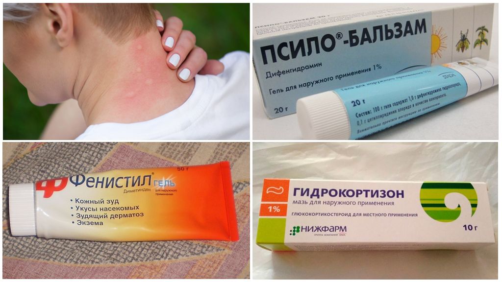 Лекарства от укуса комара
