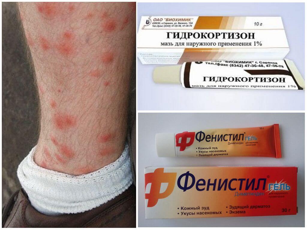 Мази от укусов блох