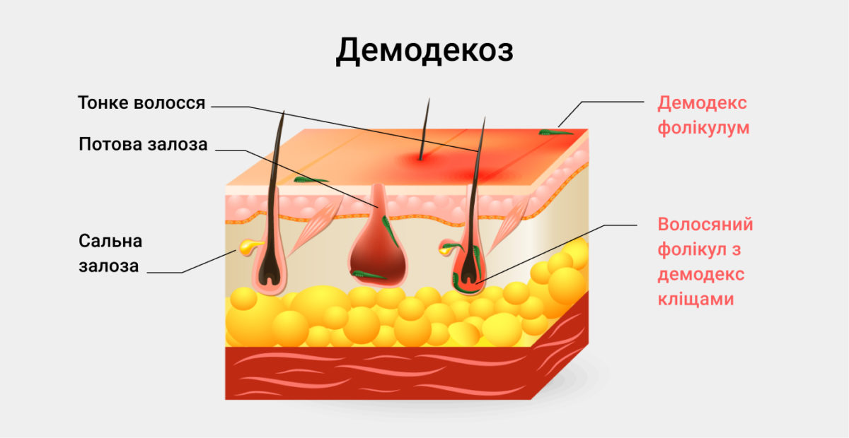 Подкожный клещ у человека — описание и причины появления