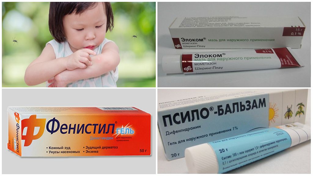 Средства при аллергии на укус комара