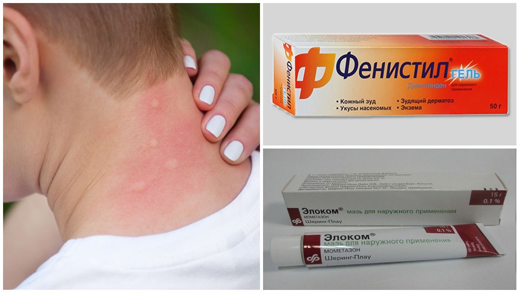 Средства для лечения аллергии
