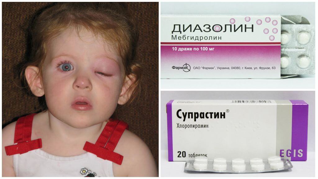 Препараты от аллергии на укус насекомого