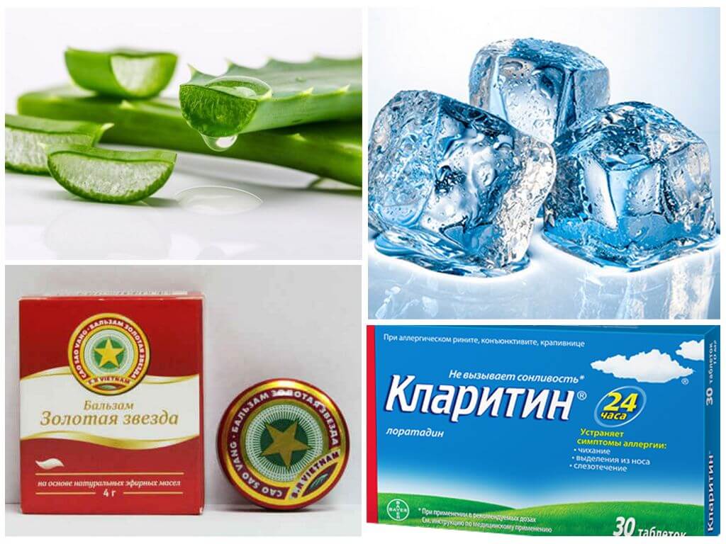 Средства от зуда на коже после укуса