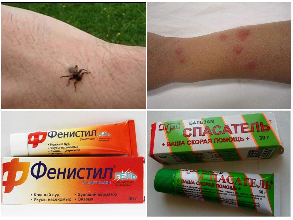 Укус лосиной вши