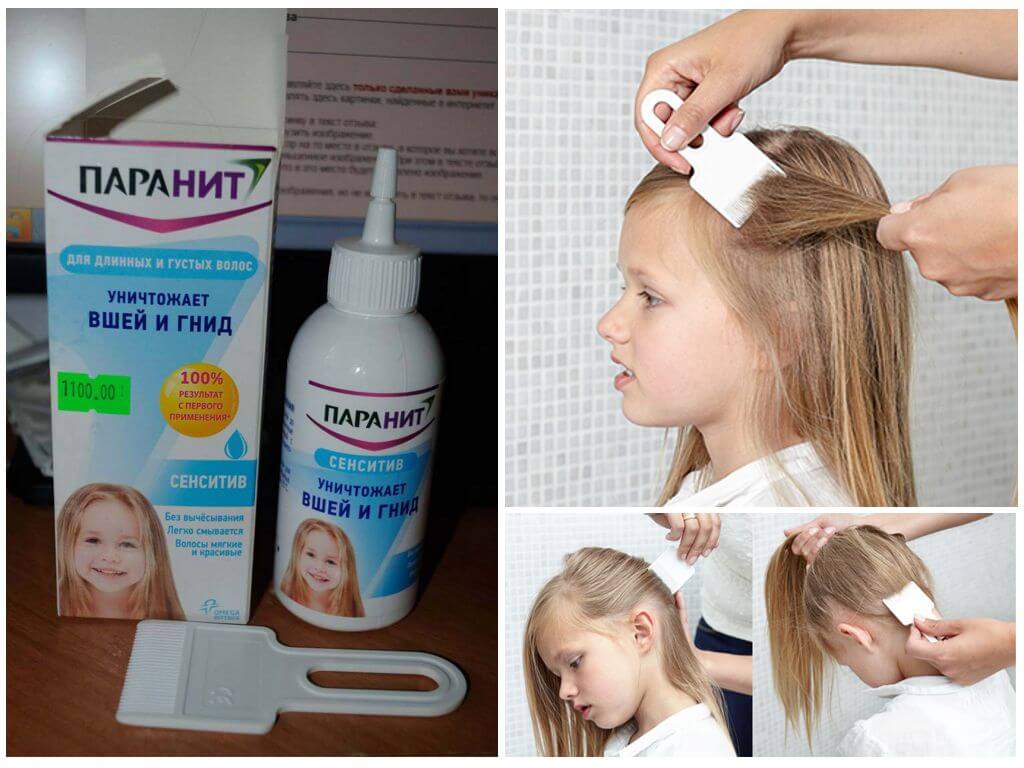 Вычесывание гнид